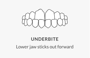 Jaw Misalignment